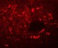 SQSTM1 Antibody